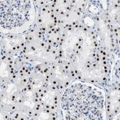 Anti-PTDSS1 antibody produced in rabbit Prestige Antibodies® Powered by Atlas Antibodies, affinity isolated antibody, buffered aqueous glycerol solution