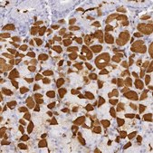 Anti-CKB antibody produced in rabbit Prestige Antibodies® Powered by Atlas Antibodies, affinity isolated antibody, buffered aqueous glycerol solution