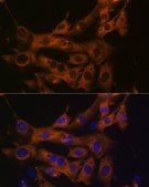 Anti-Fatty Acid Synthase (FASN) antibody produced in rabbit