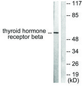 Anti-Thyroid Hormone Receptor β, N-Terminal antibody produced in rabbit affinity isolated antibody