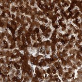 Anti-CRP antibody produced in rabbit Prestige Antibodies® Powered by Atlas Antibodies, affinity isolated antibody, buffered aqueous glycerol solution, Ab2