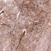 Anti-MCAM antibody produced in mouse Prestige Antibodies® Powered by Atlas Antibodies, clone CL12855, purified by using Protein A, buffered aqueous glycerol solution