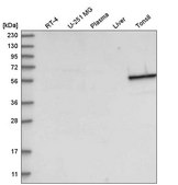 Anti-KRT4 antibody produced in rabbit Prestige Antibodies® Powered by Atlas Antibodies, affinity isolated antibody, buffered aqueous glycerol solution