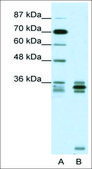 Anti-OLIG2 (AB1) antibody produced in rabbit affinity isolated antibody