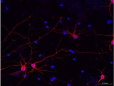 Milli-Mark® 泛神经元标志物 Milli-Mark Pan Neuronal Marker is an antibody targeting the Pan Neuronal Marker protein, validated for use in ICC, IHC, IF &amp; IHC.