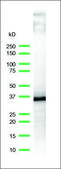 Anti-CD20 antibody, Rabbit monoclonal clone SP32, recombinant, expressed in proprietary host, affinity isolated antibody