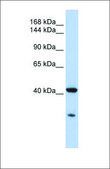 Anti-GNAS antibody produced in rabbit affinity isolated antibody