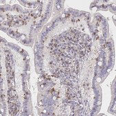 Anti-PIK3CD antibody produced in rabbit Prestige Antibodies® Powered by Atlas Antibodies, affinity isolated antibody, buffered aqueous glycerol solution