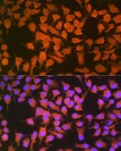 Anti-CBS antibody produced in rabbit