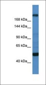 Anti-TCF20 antibody produced in rabbit affinity isolated antibody