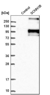 Anti-SCNN1B antibody produced in rabbit Prestige Antibodies® Powered by Atlas Antibodies, affinity isolated antibody, buffered aqueous glycerol solution