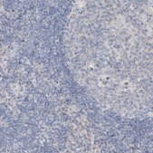 Anti-DNAH5 antibody produced in rabbit Prestige Antibodies® Powered by Atlas Antibodies, affinity isolated antibody, buffered aqueous glycerol solution