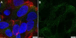 Anti-RAGE Antibody, clone 1I22 ZooMAb® Rabbit Monoclonal recombinant, expressed in HEK 293 cells