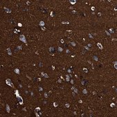 Anti-GAP43 antibody produced in rabbit Prestige Antibodies® Powered by Atlas Antibodies, affinity isolated antibody, buffered aqueous glycerol solution