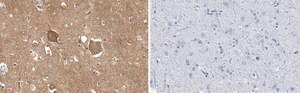 Anti-Trk-B Antibody, clone 2B22 ZooMAb® Rabbit Monoclonal recombinant, expressed in HEK 293 cells