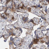 Anti-MMP16 antibody produced in rabbit Prestige Antibodies® Powered by Atlas Antibodies, affinity isolated antibody, buffered aqueous glycerol solution