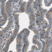 Anti-POR antibody produced in rabbit Prestige Antibodies® Powered by Atlas Antibodies, affinity isolated antibody, buffered aqueous glycerol solution