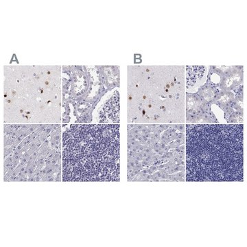 Anti-TBR1 Prestige Antibodies® Powered by Atlas Antibodies, affinity isolated antibody