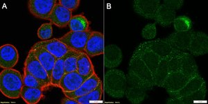 Anti-MMP-7 Antibody, clone 2B3 ZooMAb® Rabbit Monoclonal recombinant, expressed in HEK 293 cells