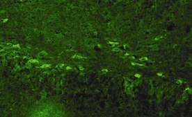 Anti-Nerve Growth Factor Antibody, pro serum, Chemicon®