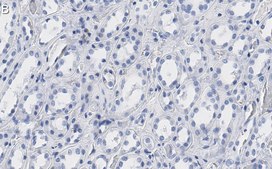 Anti-Bmi-1 Antibody, clone 1G8 ZooMAb® Rabbit Monoclonal recombinant, expressed in HEK 293 cells