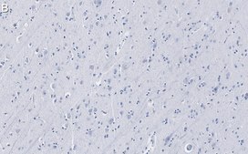 Anti-Tau Antibody, clone 3D20 ZooMAb® Rabbit Monoclonal recombinant, expressed in HEK 293 cells