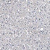 Anti-MURC antibody produced in rabbit Prestige Antibodies® Powered by Atlas Antibodies, affinity isolated antibody, buffered aqueous glycerol solution, Ab3