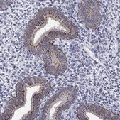 Anti-ST6GALNAC1 antibody produced in rabbit Prestige Antibodies® Powered by Atlas Antibodies, affinity isolated antibody, buffered aqueous glycerol solution