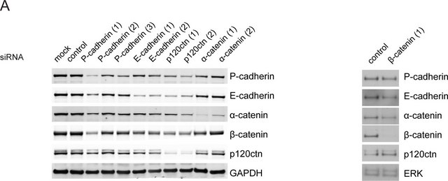 Anti-β-Catenin antibody produced in rabbit whole antiserum