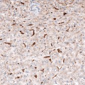 Monoclonal Anti-GRN antibody produced in mouse Prestige Antibodies® Powered by Atlas Antibodies, clone CL5695, purified immunoglobulin, buffered aqueous glycerol solution