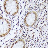 Anti-Phospho-ABL1-Y412 antibody produced in rabbit