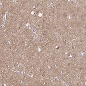 Anti-TLN2 Prestige Antibodies® Powered by Atlas Antibodies, affinity isolated antibody
