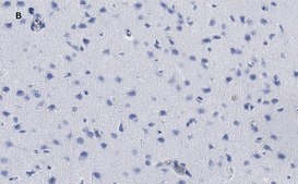 Anti-phospho-GluR1 (Ser831) Antibody, clone N453, ZooMAb® Rabbit Monoclonal recombinant, expressed in HEK 293 cells