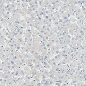 Anti-MUC1 antibody produced in rabbit Prestige Antibodies® Powered by Atlas Antibodies, affinity isolated antibody, buffered aqueous glycerol solution