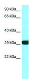 Anti-RPS3 (C-terminal) antibody produced in rabbit affinity isolated antibody