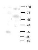 Anti-OLIG2 (AB2) antibody produced in rabbit affinity isolated antibody