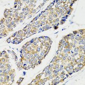 Anti-IKBKG antibody produced in rabbit