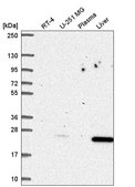 Anti-CDKN1B antibody produced in rabbit Prestige Antibodies® Powered by Atlas Antibodies, affinity isolated antibody