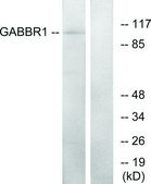 Anti-GABBR1 antibody produced in rabbit affinity isolated antibody