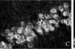 Anti-NeuN Antibody, clone A60 clone A60, Chemicon®, from mouse