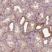 Anti-STAT3 antibody produced in rabbit Prestige Antibodies® Powered by Atlas Antibodies, affinity isolated antibody, buffered aqueous glycerol solution