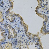 Anti-GLUL antibody produced in rabbit