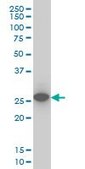 Monoclonal Anti-UCHL1 antibody produced in mouse clone 1B8-4D2, purified immunoglobulin, buffered aqueous solution
