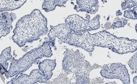 Anti-Transglutaminase 2 Antibody, clone 1G20 ZooMAb® Rabbit recombinant, expressed in HEK 293 cells