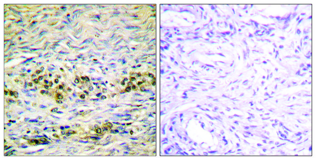 Anti-AKT antibody produced in rabbit affinity isolated antibody