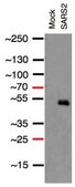 Anti-SARS-CoV-1/2 NP Antibody, clone 1C7C7 ZooMAb® Mouse Monoclonal recombinant, expressed in HEK 293 cells