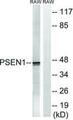 Anti-PSEN1 antibody produced in rabbit affinity isolated antibody