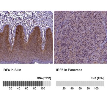 Anti-IRF6 antibody produced in rabbit Prestige Antibodies® Powered by Atlas Antibodies, affinity isolated antibody, buffered aqueous glycerol solution