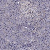 Anti-ITGB1 Prestige Antibodies® Powered by Atlas Antibodies, affinity isolated antibody