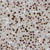 Monoclonal Anti-ERCC1 antibody produced in mouse Prestige Antibodies® Powered by Atlas Antibodies, clone CL1249, purified immunoglobulin, buffered aqueous glycerol solution